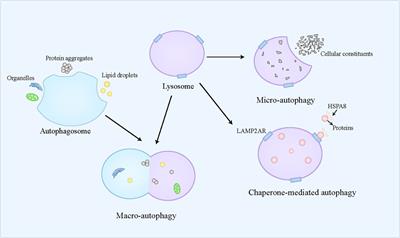 Hepatocyte programmed cell death: the trigger for inflammation and fibrosis in metabolic dysfunction-associated steatohepatitis
